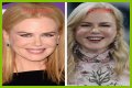 Nicole Kidman's "Lioness" Plastic Surgery: Uncovering Hidden Truths